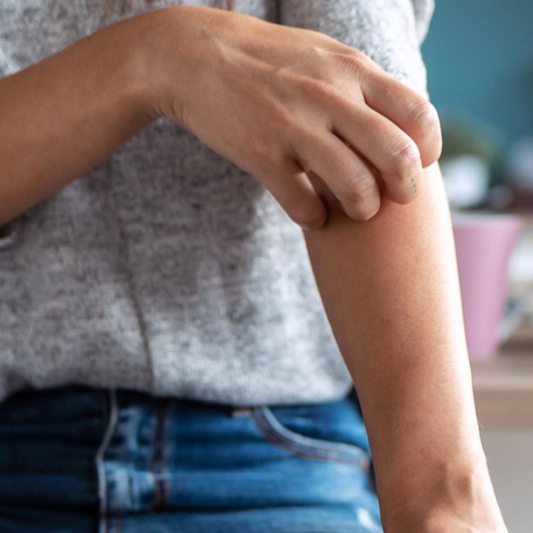 Huiles essentielles contre les moustiques : protéger toute la famille naturellement