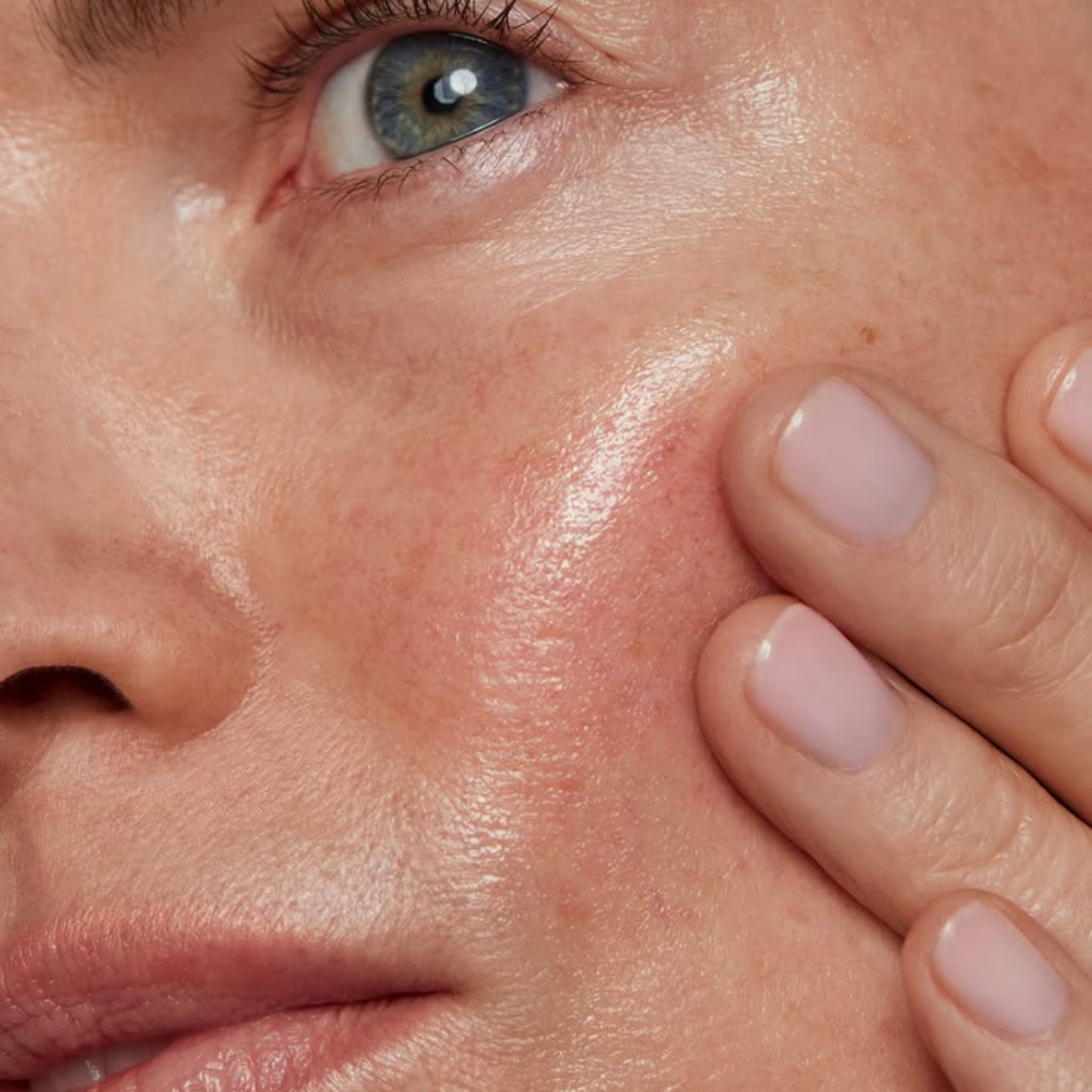 Comment prendre soin d'une peau sensible avec les huiles végétales ?