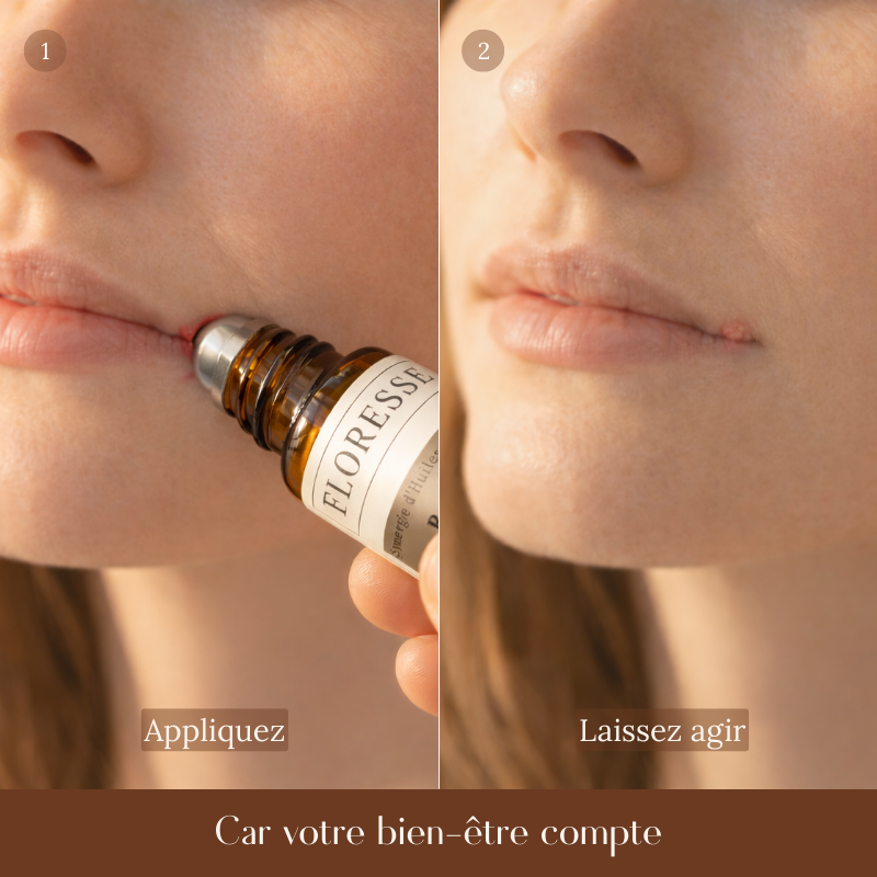 BOUTON DE FIÈVRE - Mélange d'Huiles essentielles - Roll-on - 10 ML